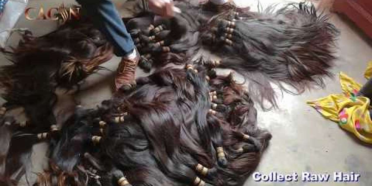 The majority of people want their hair to appear natural and to blend in with their natural hairline