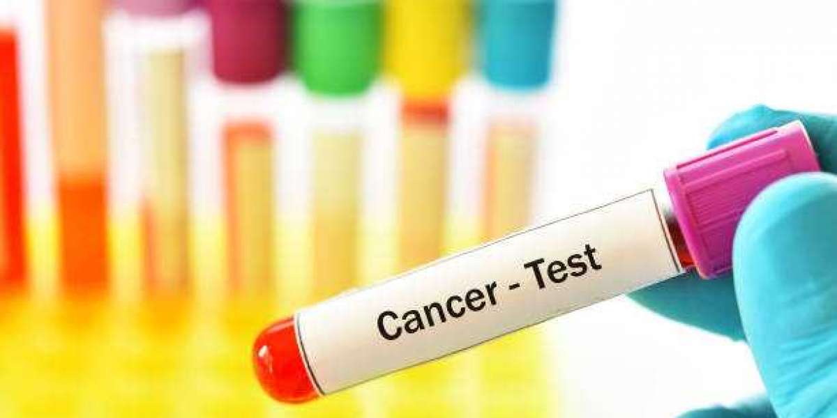 Carcinoembryonic Antigen Market Outlook, Trends, Growth Opportunities, Challenges Analysis | Industry Size Share Growth 