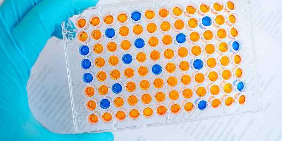 Immunoassay Analyzers Market SWOT Analysis, Key Business Strategies, Leading Industry Players, Regional Growth, Demand, 