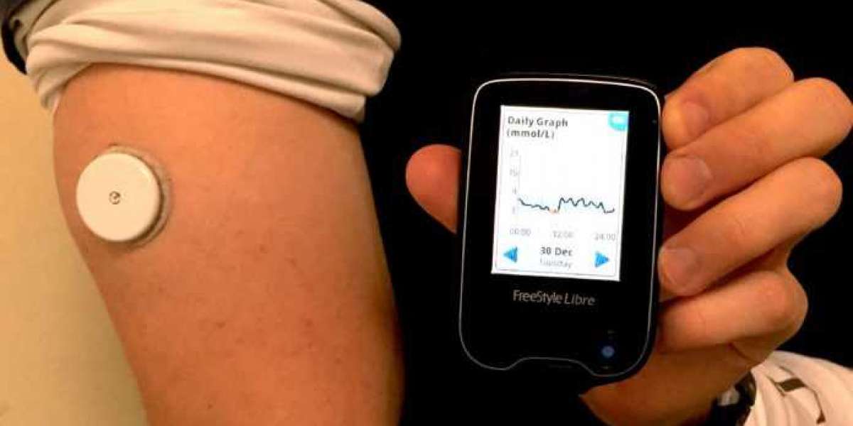 Artificial Pancreas Devices Market Approach, focus on key drivers, trends and Forecast 2028