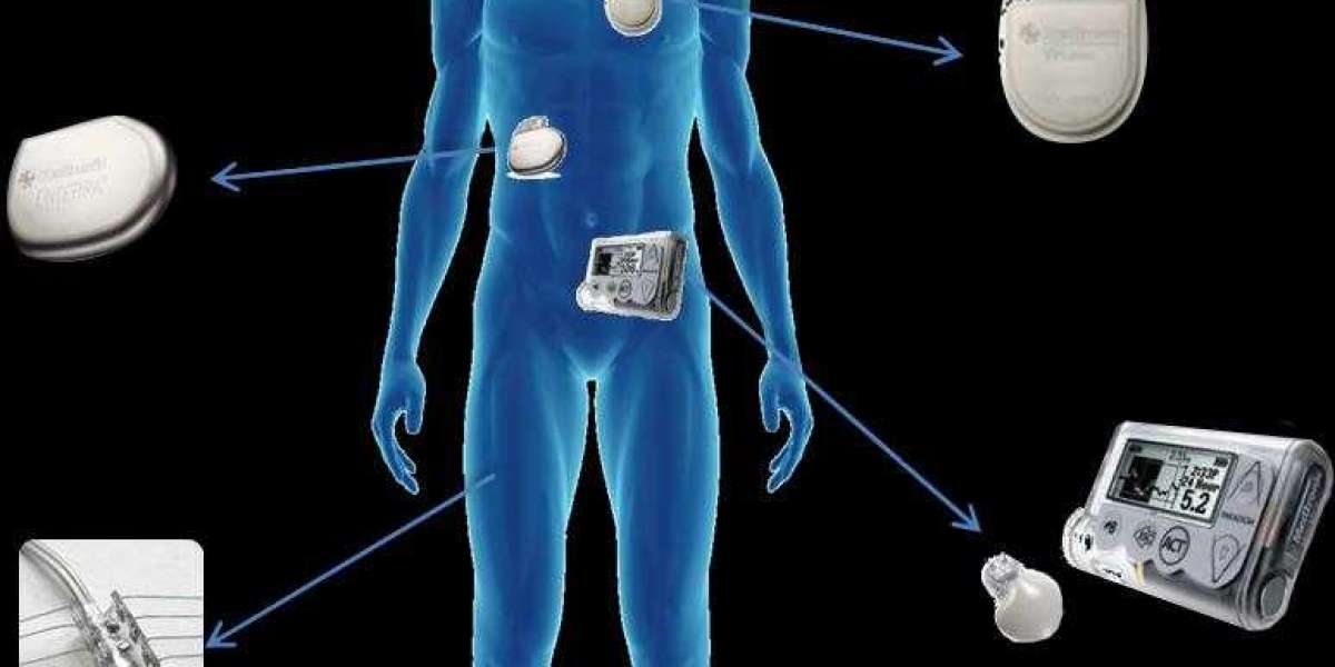 Implantable Medical Devices Market Growth Opportunities & Growth, and Demographic, Geographic Segment by 2030