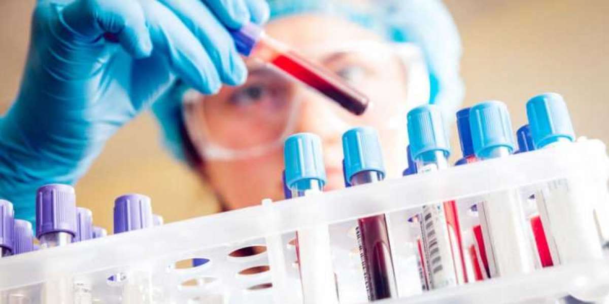 Clinical Laboratory Services Market Opportunities, Top Key Manufacturers and Supply Demand 2028
