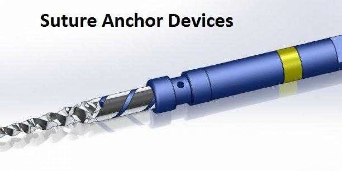 Europe Suture Anchor Devices Market Regional Study, Global Trends, Industry Growth, Top Key Players Profiles and Future 