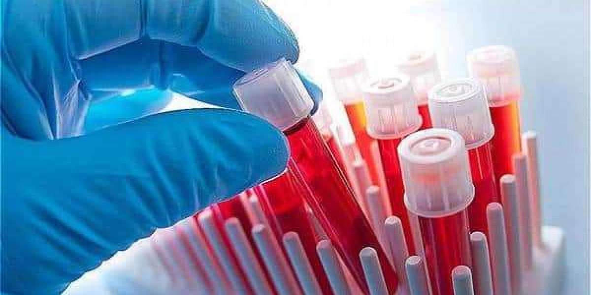 Hematology Analyzers Market Business Revenue, Future Scope, Market Trends, Key Players and Forecast  2028