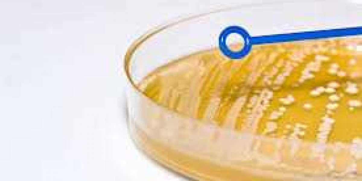 Competent Cells Market Size, Trends, Global Analysis and Forecast 2019 to 2028