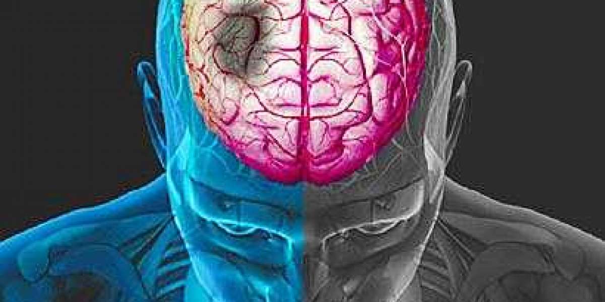 Stroke Diagnostics and Treatment Market Worldwide Analysis, Future Scope, Market Trends, Industry Size Forecast 2028