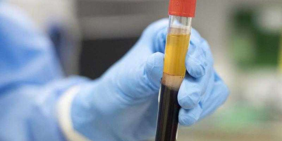 Plasma Therapy Market Potential Growth, Share, Demand and Analysis Of Key Players- Research Forecast  2028