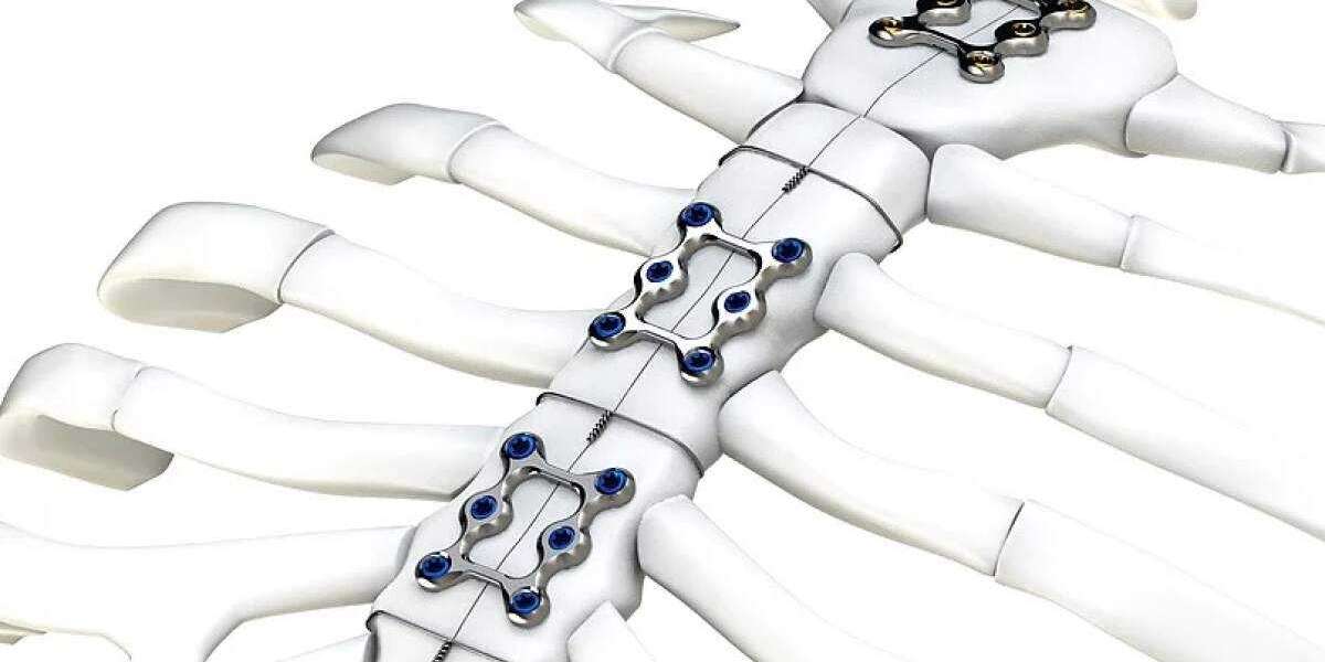 Sternal Closure Systems Market Leading Growth Drivers, Emerging Audience, Segments, Sales, Profits & Analysis Foreca