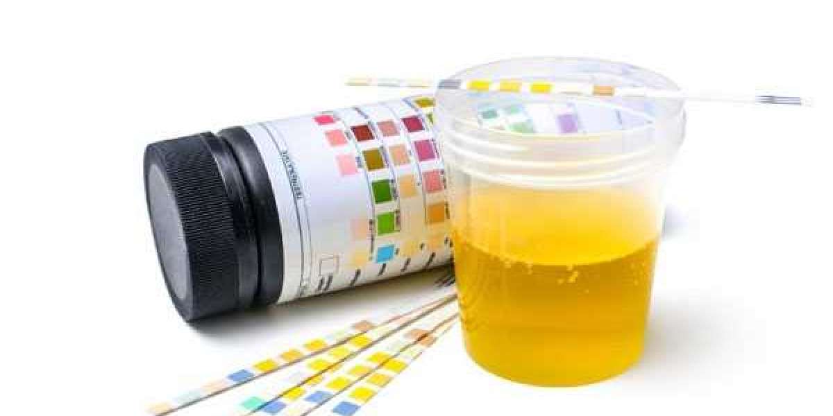 Urinalysis Market Size, Growth, Analysis, Overview & Trends during Forecast 2028