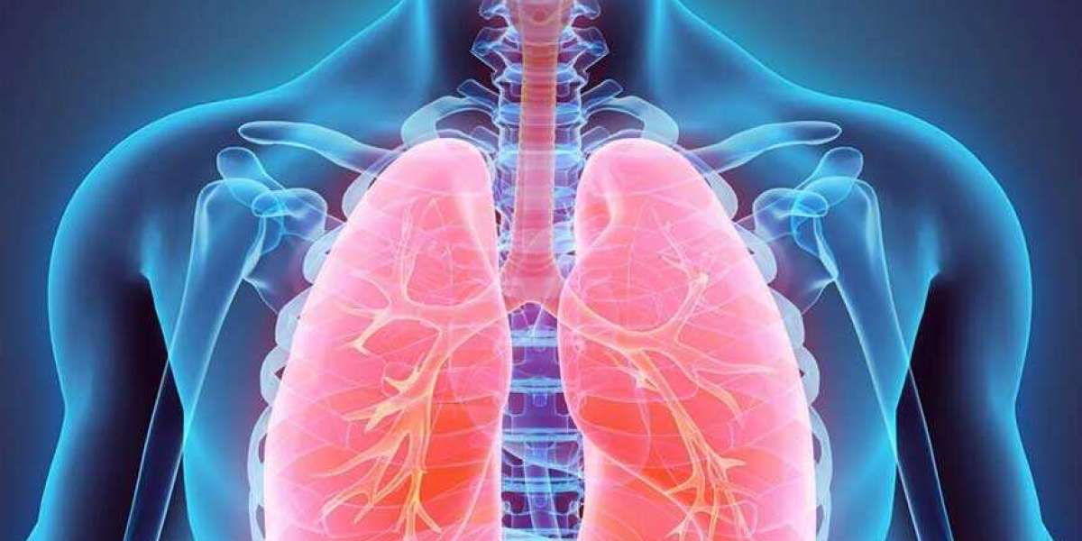 Lung Cancer Diagnostic Market to Witness Healthy Growth as Players Witness Potential Growth Opportunities 2030
