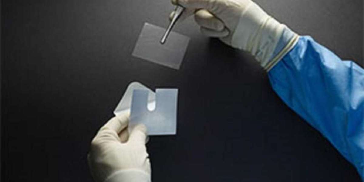 Adhesion Barrier Market  Size, Growth, Analysis, Overview & Trends during Forecast 2030