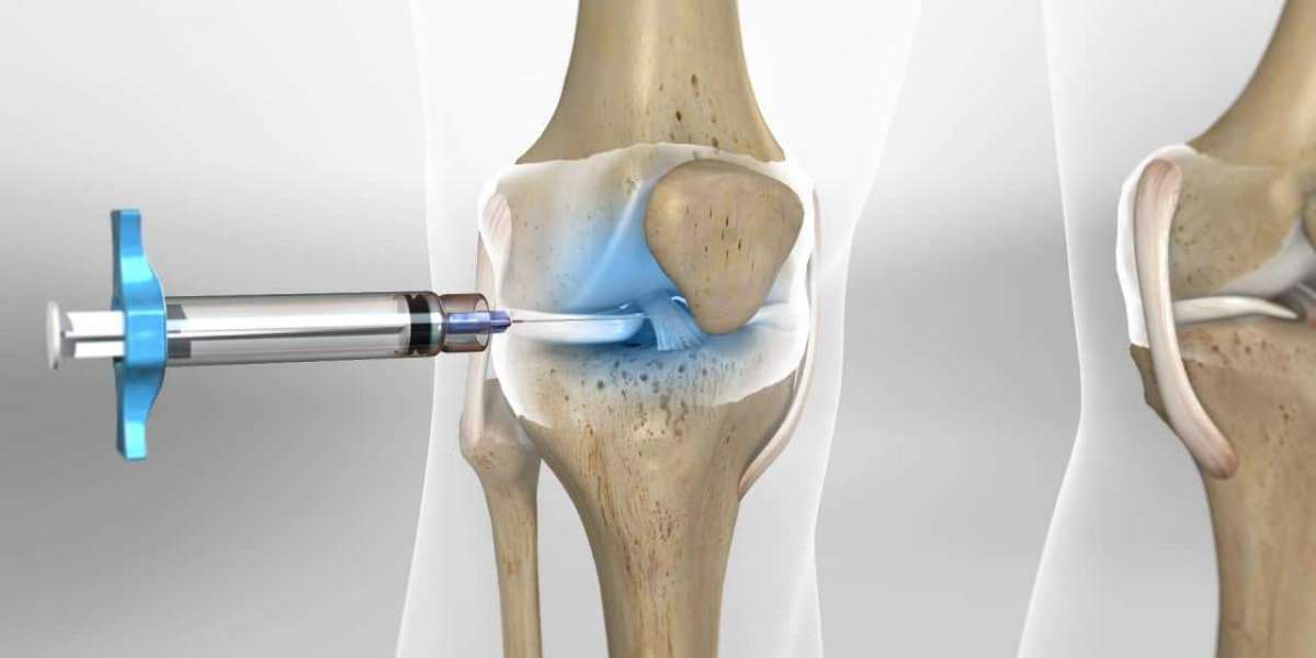 Viscosupplementation Market Outlook, Opportunity Analysis, And Forecast 2019–2028