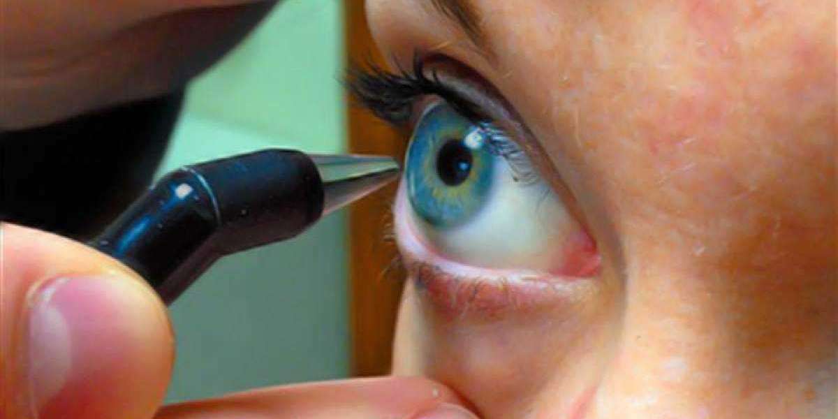 Corneal Pachymetry Market Growth Study,and Top Players Data by Forecast 2028