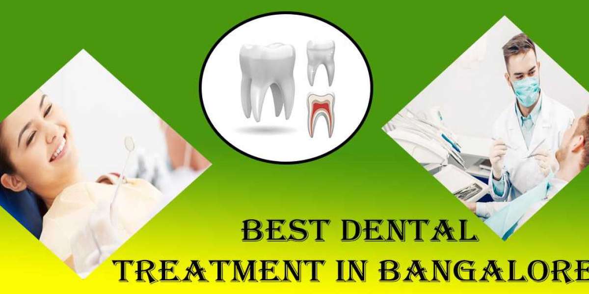 Best Dental Treatment in Bangalore | Dental Treatment