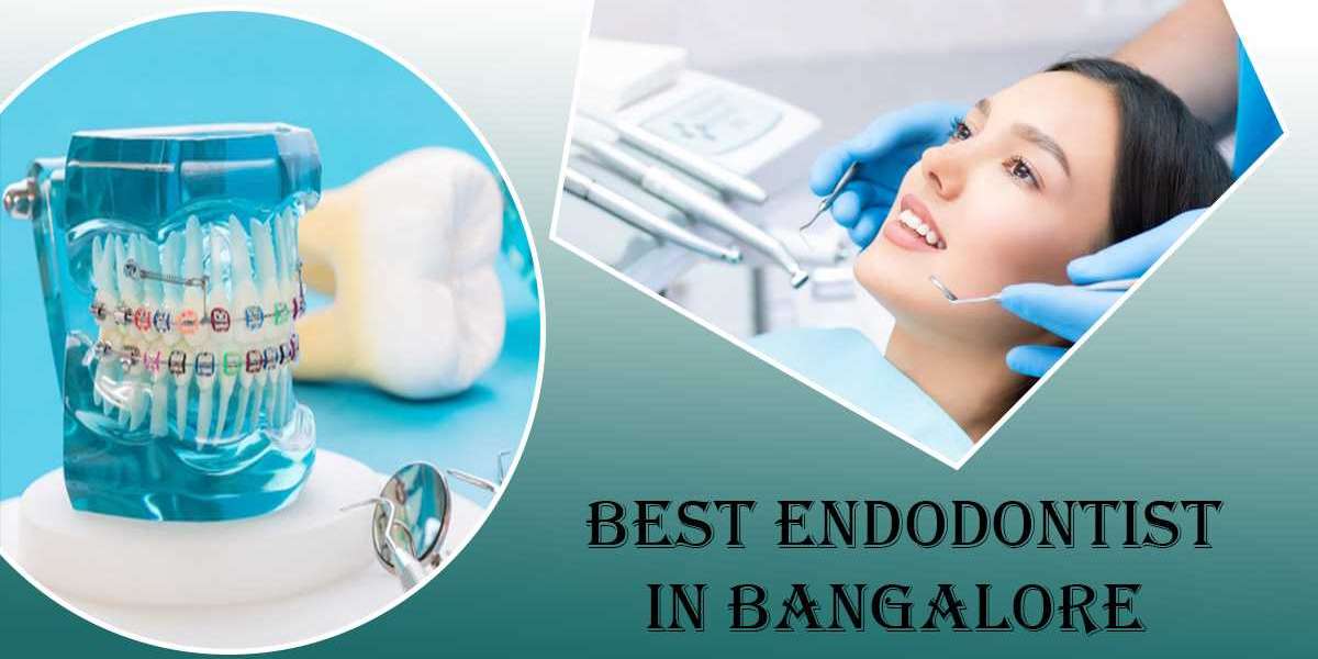 Best Endodontist in Bangalore | Endodontist in Bangalore