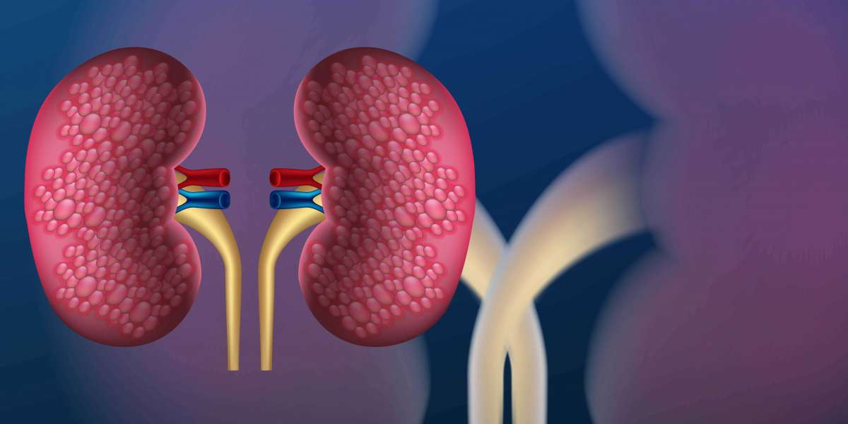 Detailed Report on Urology Care Devices and Platforms - Market Analysis and Forecast upto 2030 - BIS Research