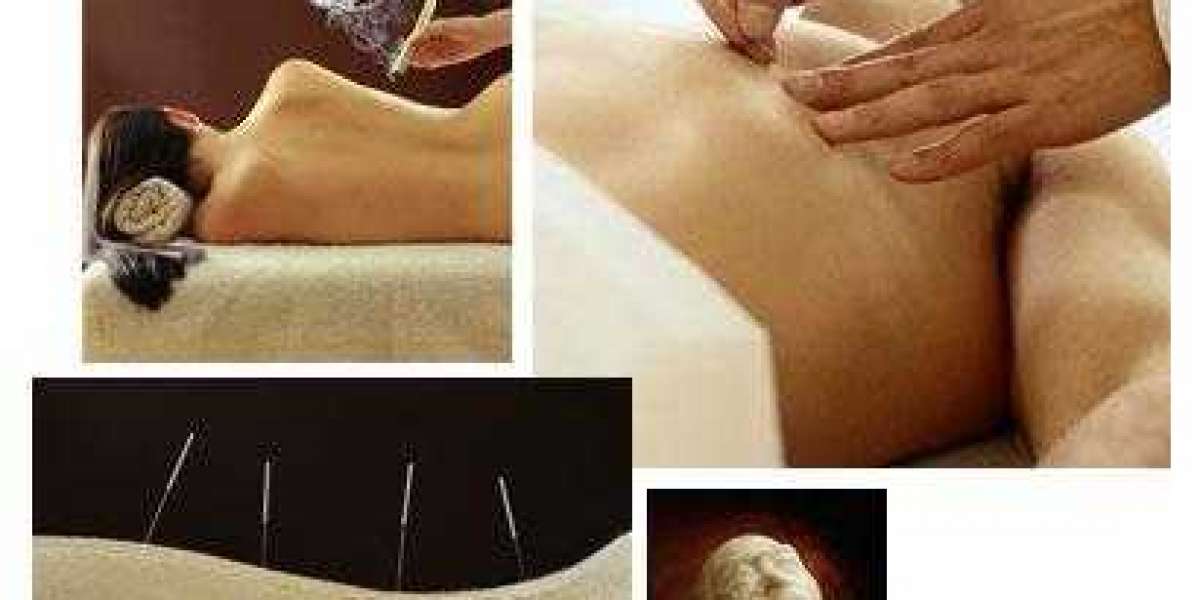 Say Goodbye to Headaches with Acupuncture!