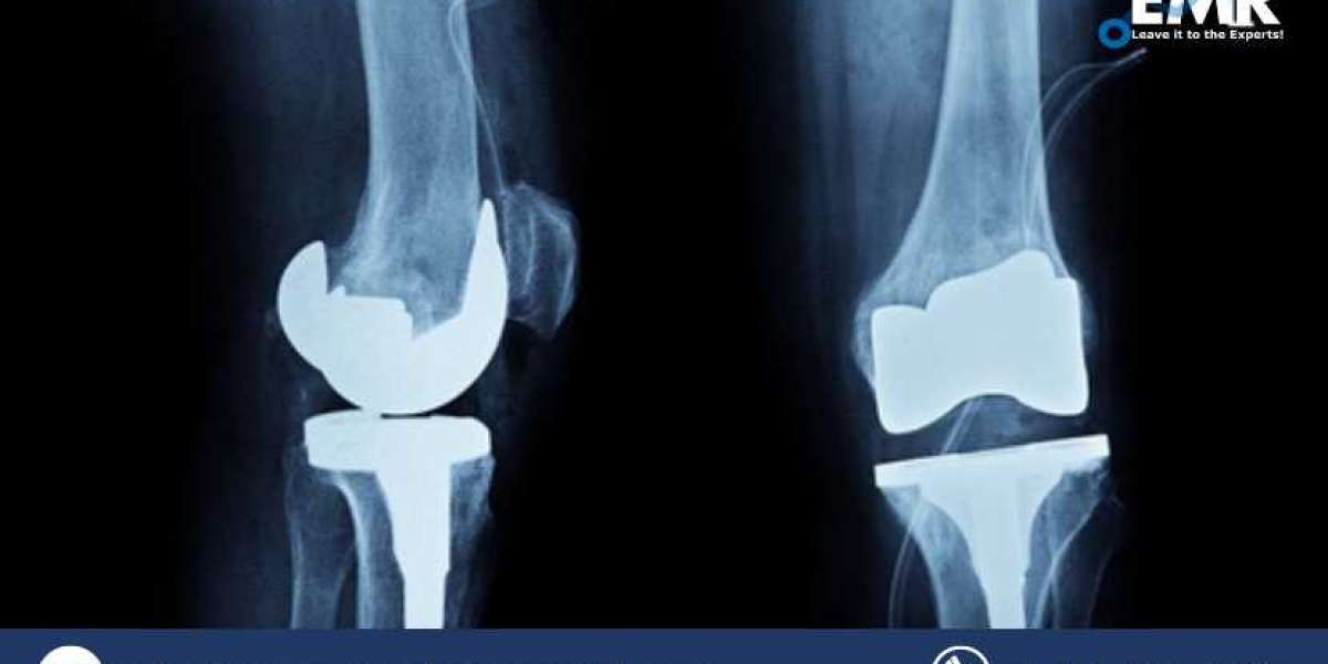 North America Bone Cement Market Size To Grow At A CAGR Of 5.80% In The Forecast Period Of 2023-2028