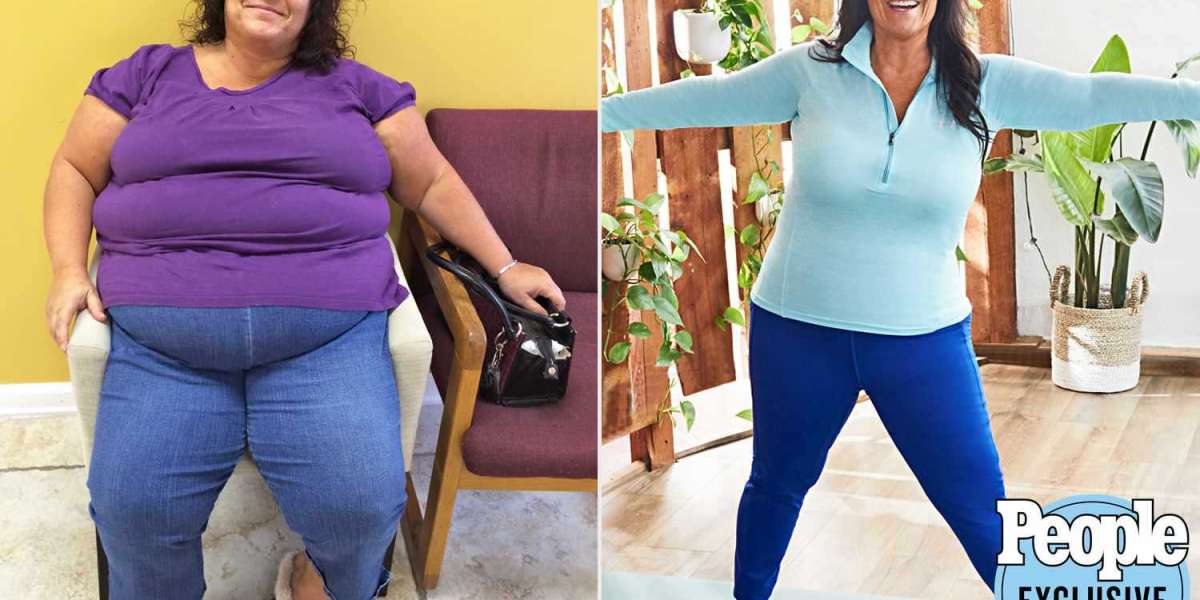 Trisha Yearwood Weight Loss Gummies