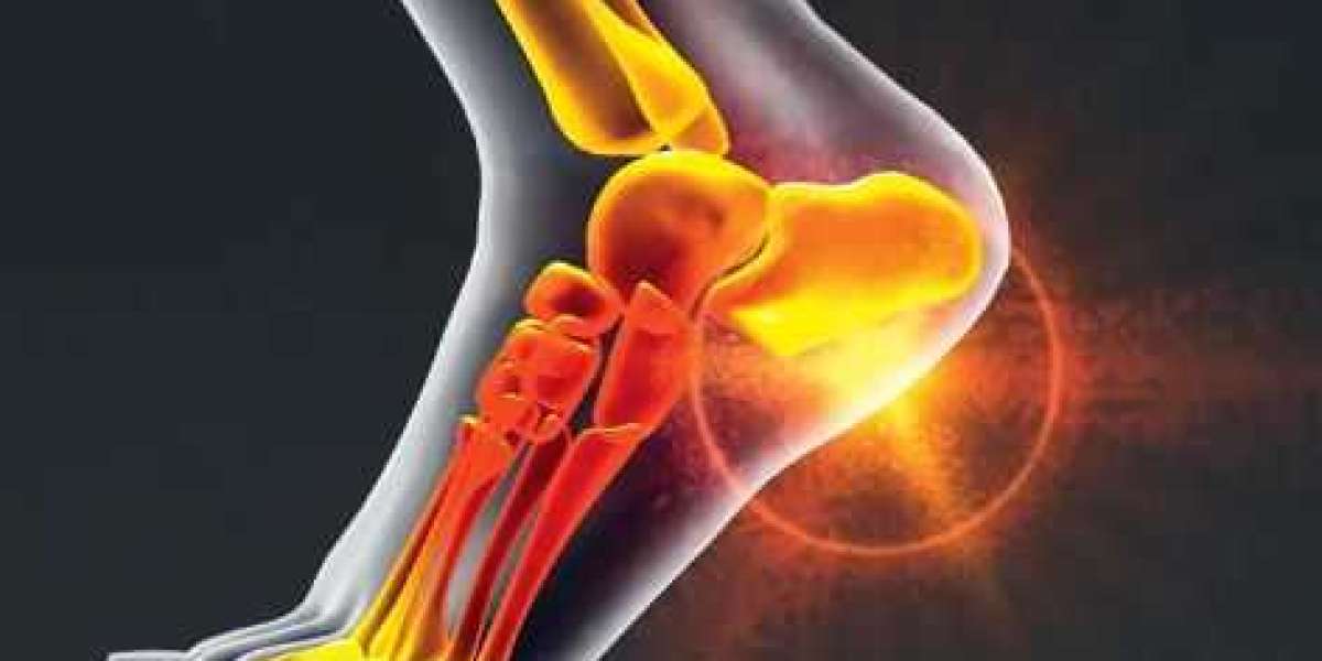 Choice CBD Gummies (2023) 100% Safe, Does It Really Work Or Not?