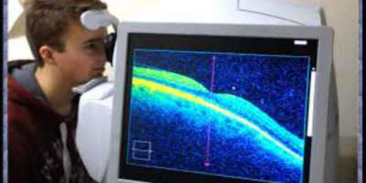 Optical Coherence Tomographer Market Size Growing at 8.2% CAGR Set to Reach USD 1876.46 Million By 2028