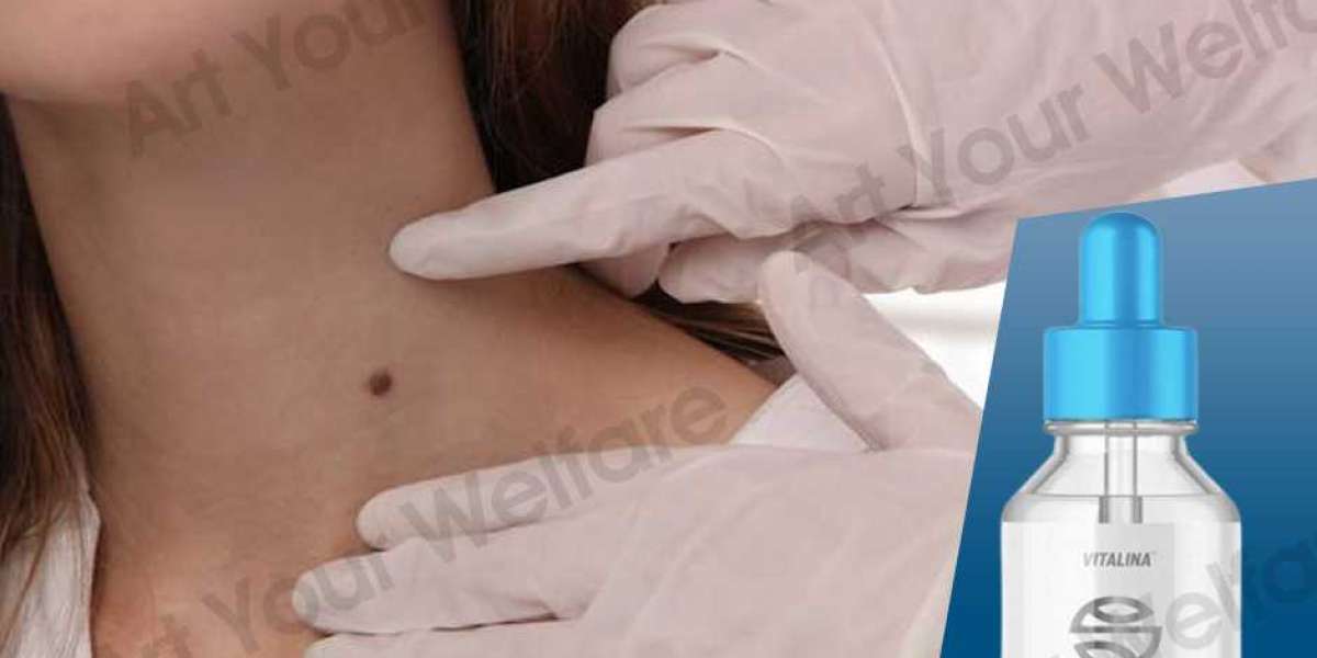 Skincell Advanced Review - Mole And Skin Tag Corrector