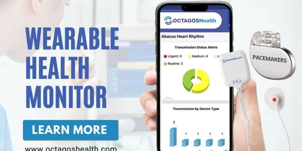 Remote Cardiac Heart Monitoring Services - Octagos Health