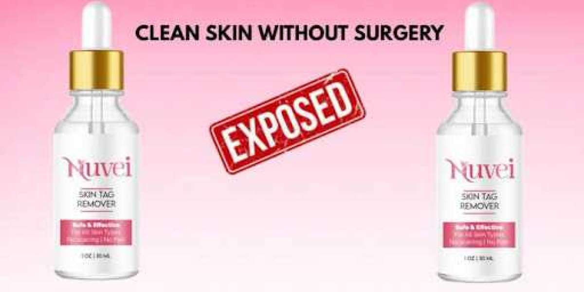 The Benefits of Using Nuvei Skin Tag Remover