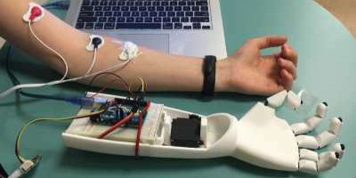 Myoelectric Prosthetics Market: Global Industry Analysis, Size, Share, Growth, Trends, and Forecasts 2023-2030