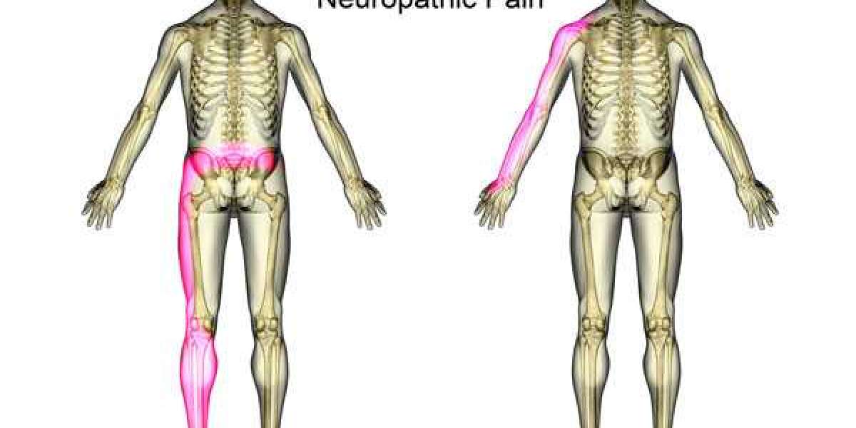 Let’s Know About The Medications Used In Treatment Of Neuropathic Pain