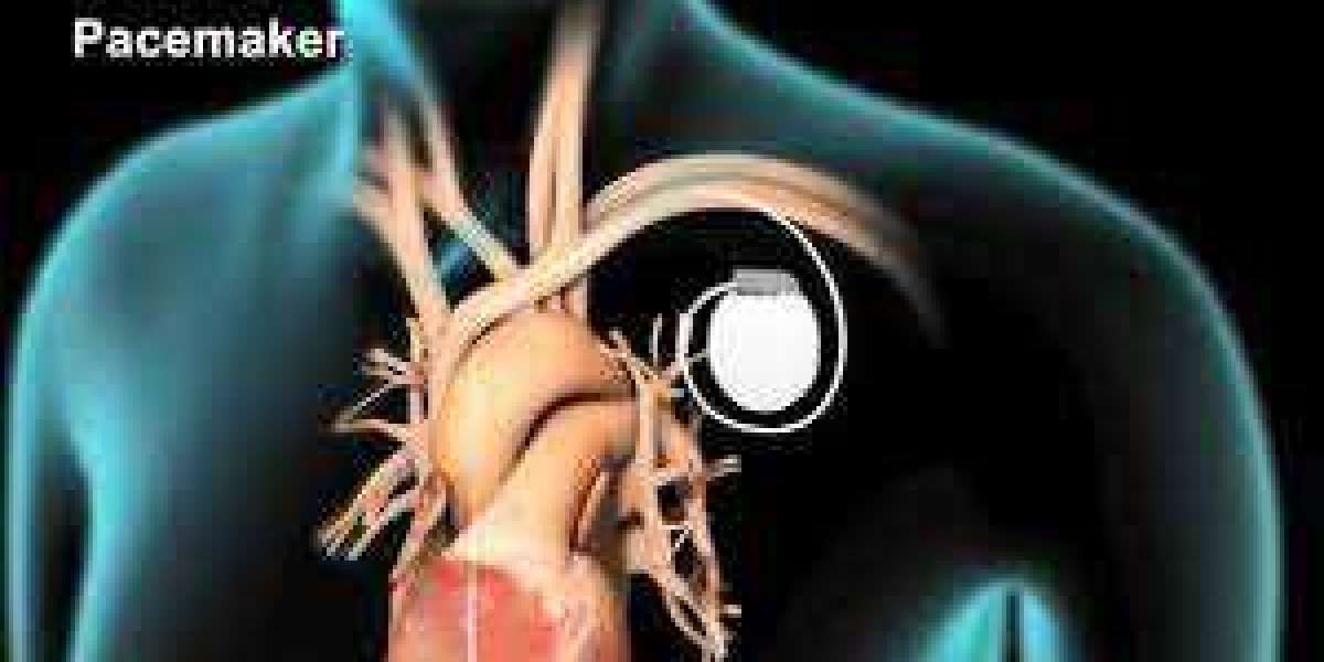 Cardiac Ablation Devices Market is Expected to Indication an 16.53% CAGR From the Forecast Period 2022-2027 – MarkNtel A