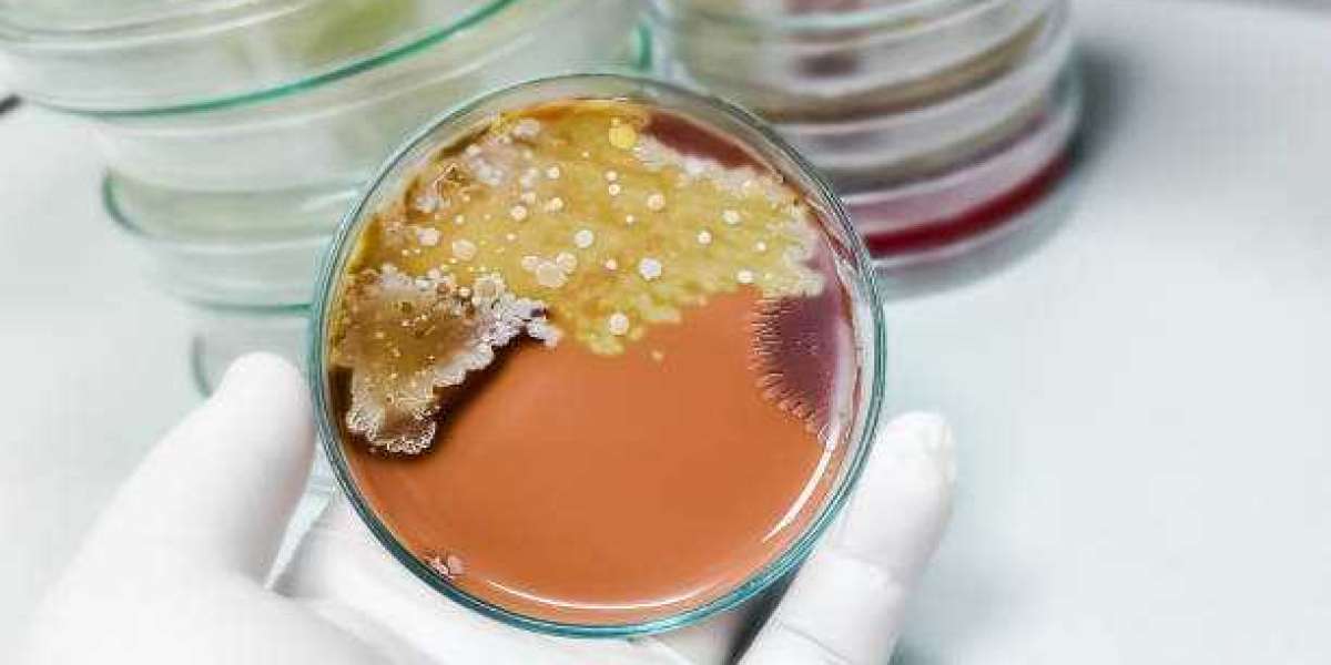 Microbial Lipase Market Share Revenue Trends, Company Profiles, Revenue Share Analysis By 2030