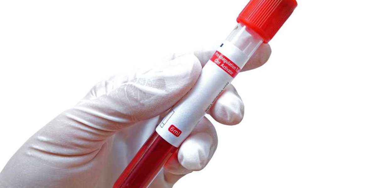The Role of Blood Coagulation Tubes in Diagnosing and Monitoring Blood Disorders