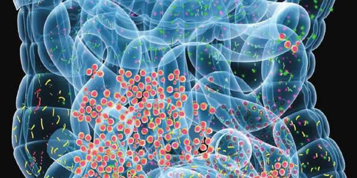 Diagnosis and Management of Hepatic Encephalopathy in Liver Disease