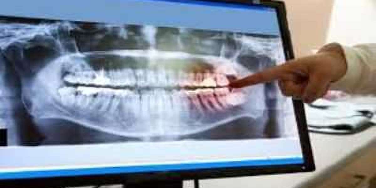 Dental Imaging Market: Global Industry Analysis, Size, Share, Growth, Trends, and Forecasts 2023-2030