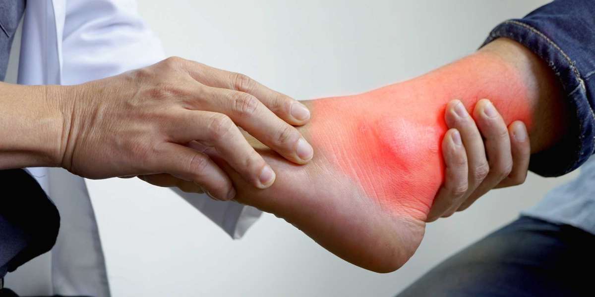Gout Disease Treatment Market Size to Expand with Increasing Healthcare Expenditure