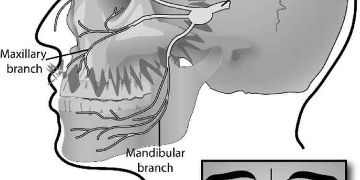 Cluster Headache Market Growth Drivers, Business Strategies and Future Prospects 2028