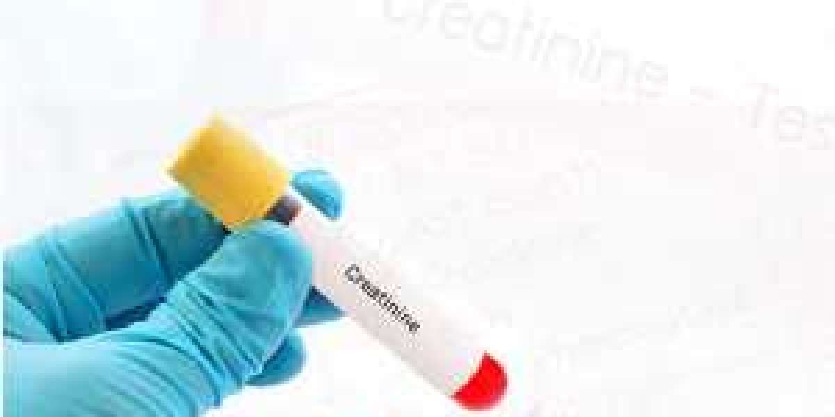 Creatinine Test Market Expected to Witness High Growth over the Forecast Period 2023-2030