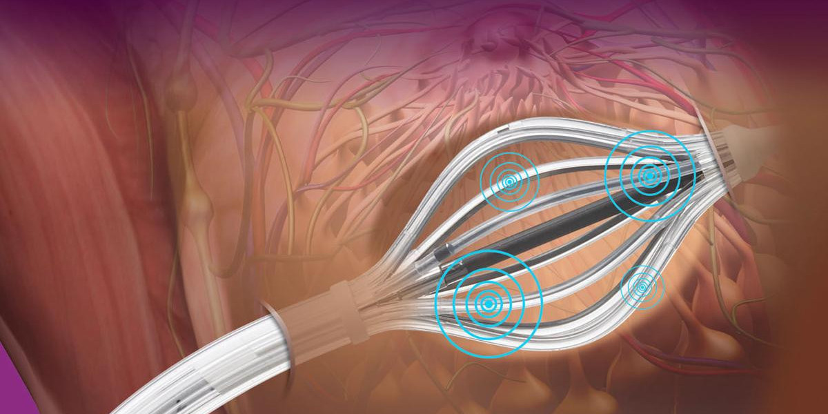 Cancerous Tumors Are Precisely Targeted From Within The Body By Brachytherapy