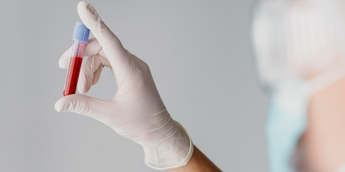 Hematologic Malignancies Testing Market Trends, Research Report, Growth, Opportunities, Forecast to 2032