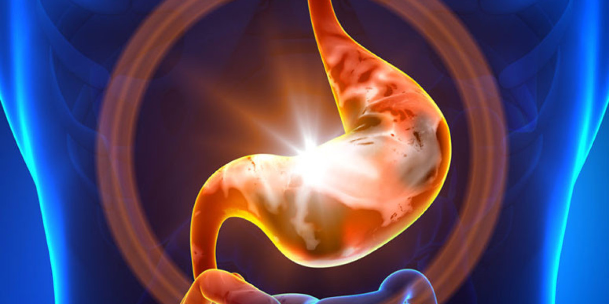 A Personalized Approach to Gastritis Treatment: Tailoring Care to Your Needs