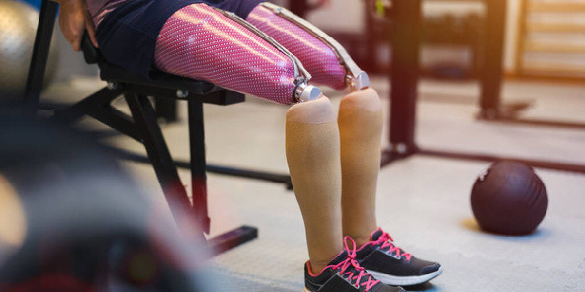 The Art and Science of Prosthetic Leg Customization
