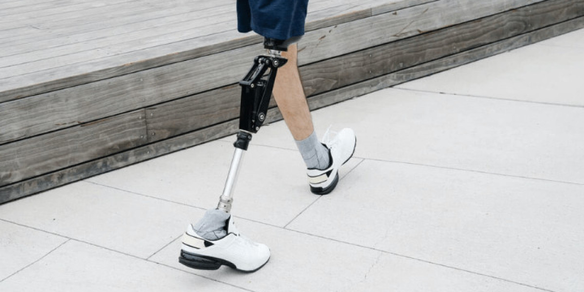 Breaking Barriers: How Prosthetic Legs are Changing Lives
