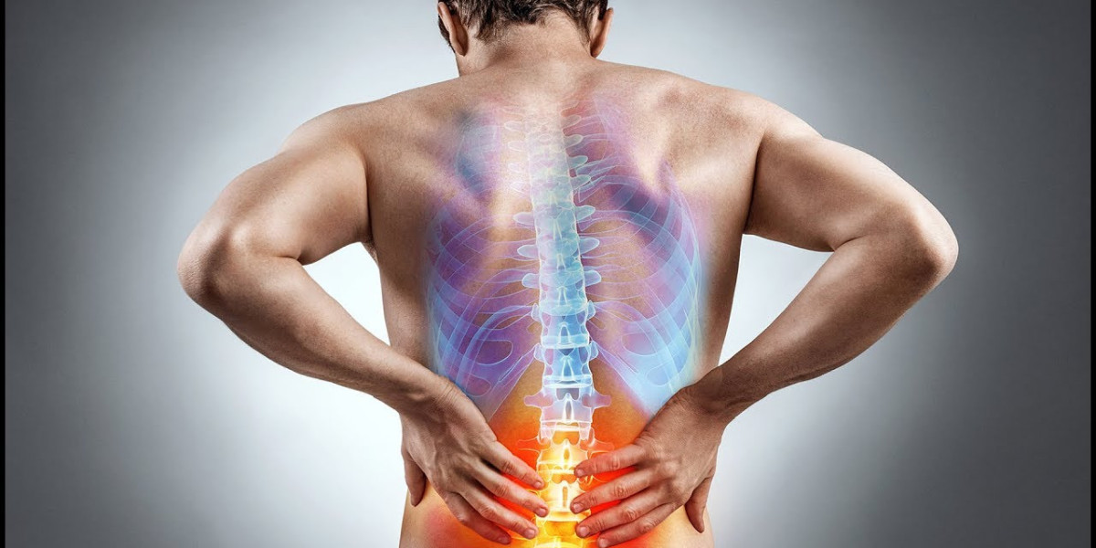 In Sciatica, The Sciatic Nerve Causes Pain Along Its Path
