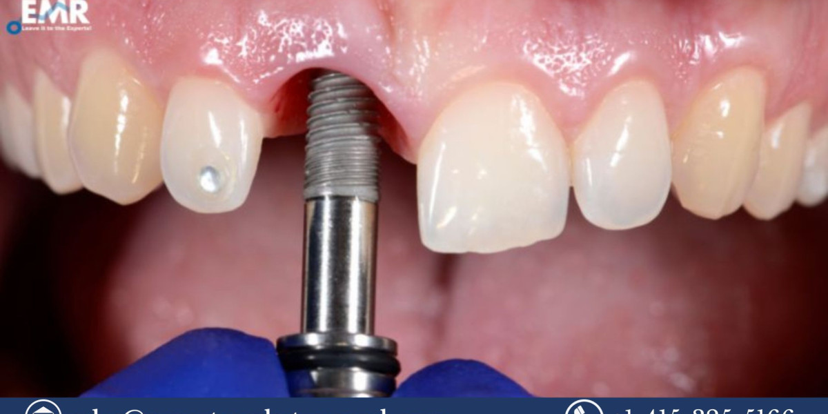 Aesthetic Implants Market Share, Price, Trends, Growth, Analysis Report and Forecast 2023-2031