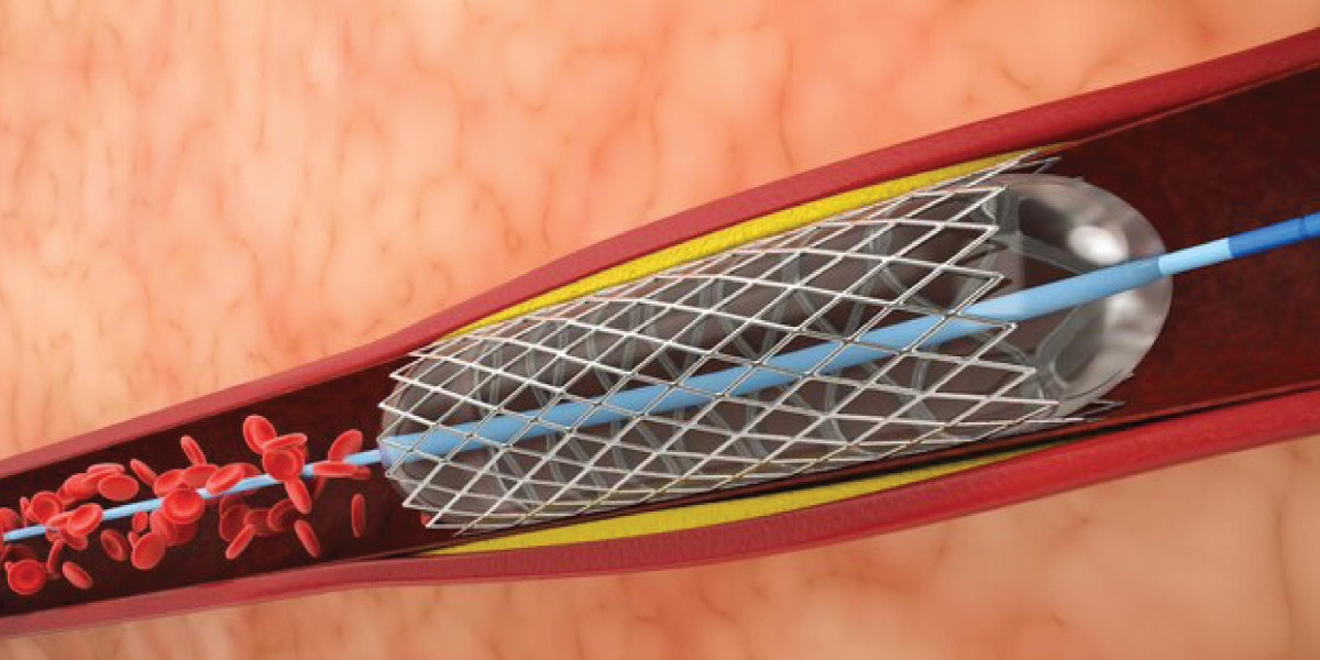 Fractional Flow Reserve Market Size & Share Report 2027