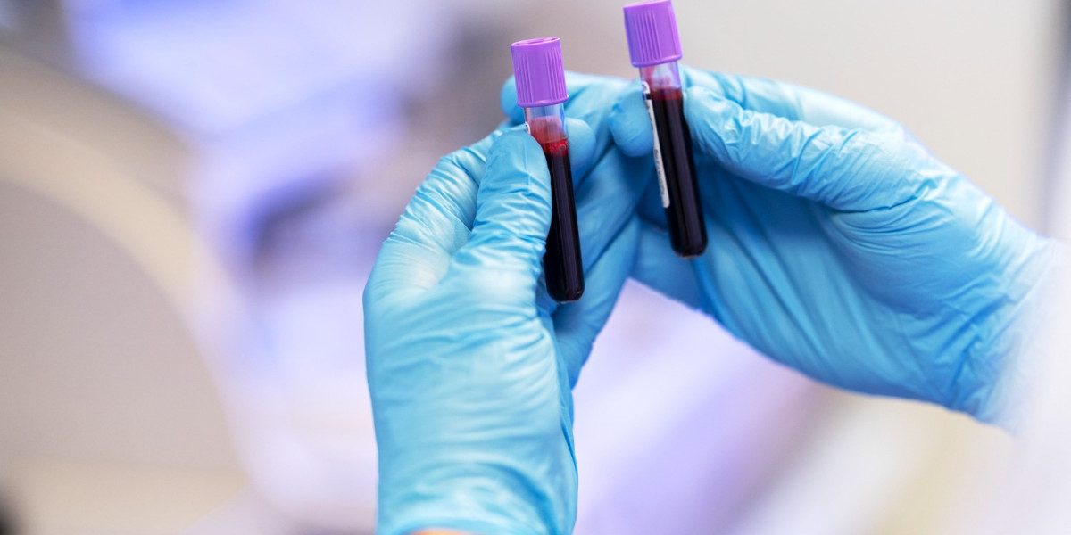 Revolutionizing Cancer Screening: Multicancer Screening Market Expected to Reach $7.7 Billion by 2032