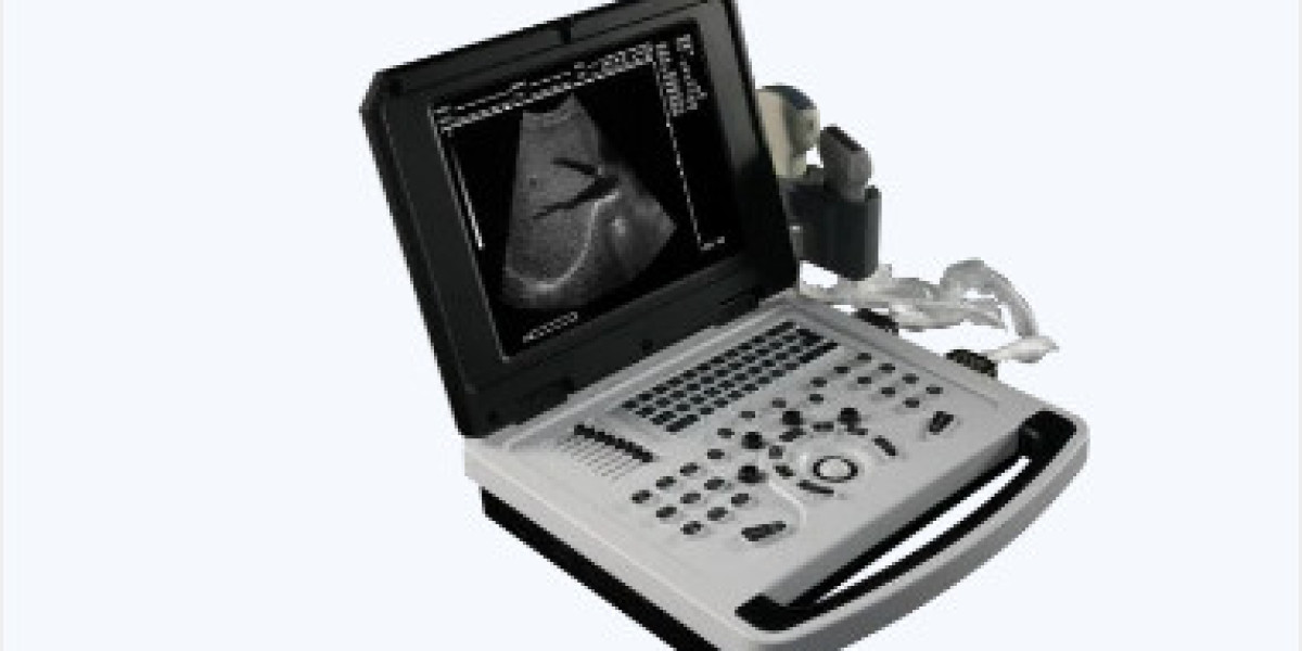 What are the technical features and advantages of the EC-83 full digital ultrasonic scanner