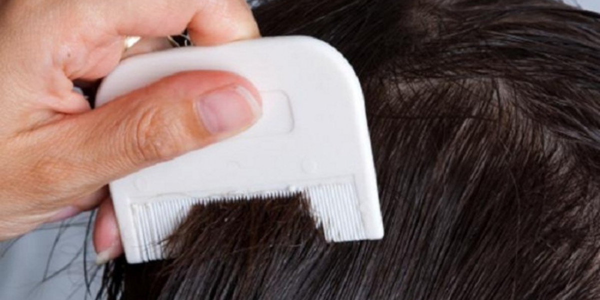 Lice Treatment for Adults: What You Need to Know?