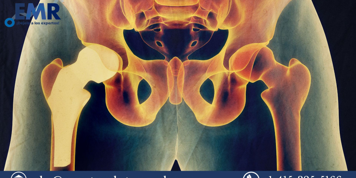 Hip Replacement Implants Market Share, Price, Trends, Growth, Analysis Report and Forecast 2023-2031